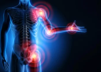 Una scoperta apre la strada a statine senza dolori muscolari